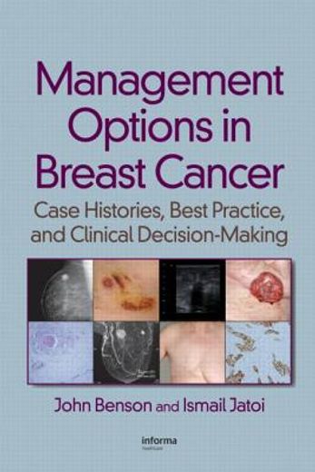 management options in breast cancer,case histories, best practice, and clinical decision-making
