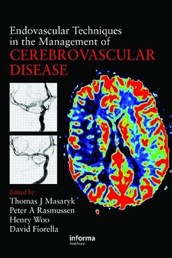 endovascular techniques in the management of cerebrovascular disease
