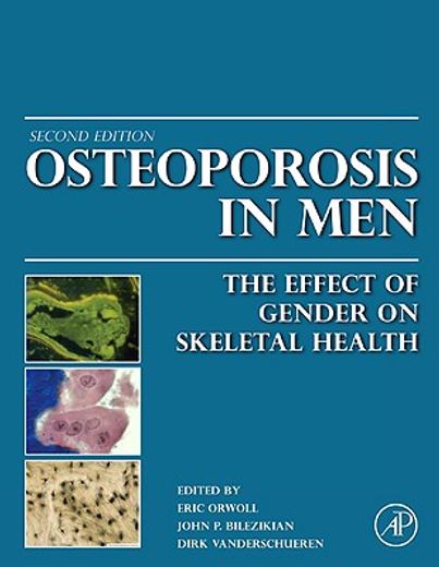 osteoporosis in men,the effects of gender on skeletal health