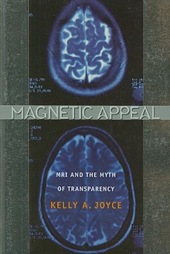 magnetic appeal,mri and the myth of transparency