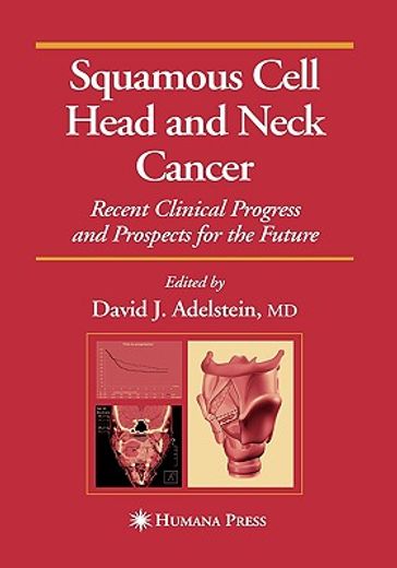 squamous cell head and neck cancer,recent clinical progress and prospects for the future