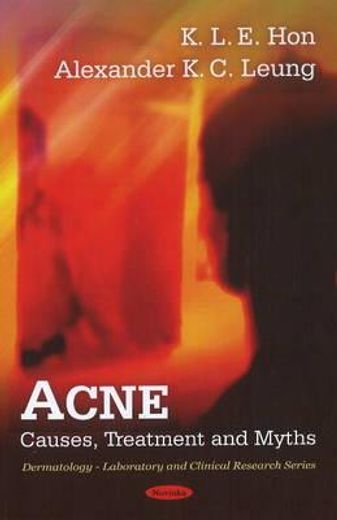 acne,causes, treatment and myths