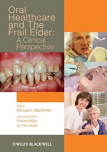 oral healthcare and the frail elder,a clinical perspective