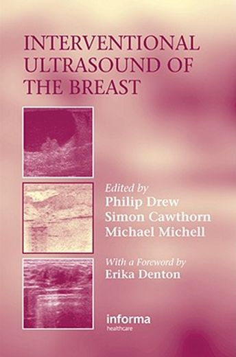 Interventional Ultrasound of the Breast (en Inglés)