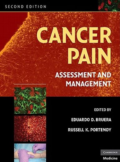 cancer pain,assessment and management