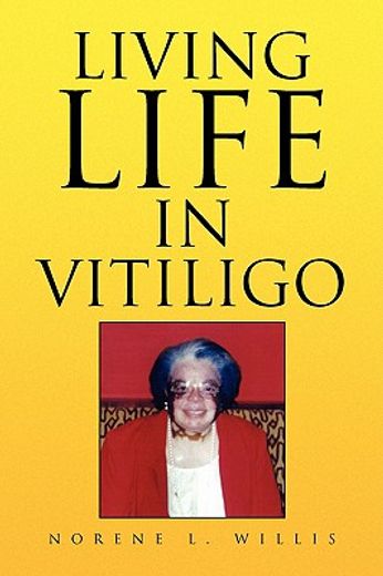 living life in vitiligo