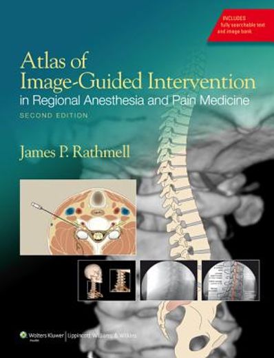 Atlas of Image-Guided Intervention in Regional Anesthesia and Pain Medicine (en Inglés)