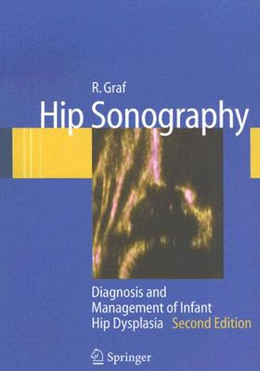 hip sonography,diagnosis and management of infant hip dysplasia