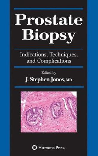prostate biopsy,indications, techniques, and complications