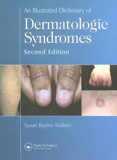 An Illustrated Dictionary of Dermatologic Syndromes (en Inglés)