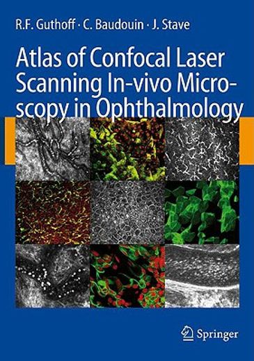 atlas of confocal laser scanning in-vivo microscopy in ophthalmology,principles and applications in diagnostic and therapeutic ophthalmology