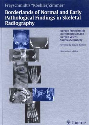 freyschmidt´s koehler/zimmer´s borderlands of normal and early pathological findings in skeletal radiography