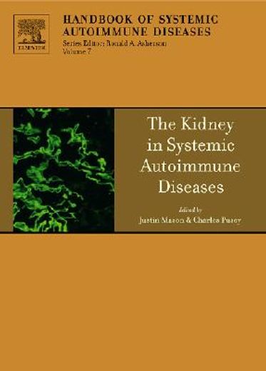 kidney in systemic autoimmune diseases