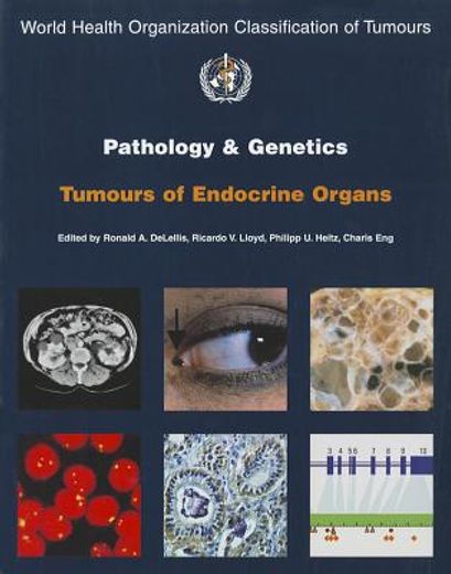 pathology and genetics of tumors of endocrine organs