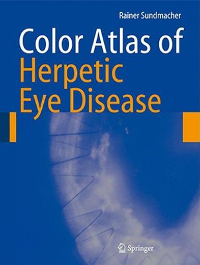 color atlas of herpetic eye diseases,a practical guide to clinical management