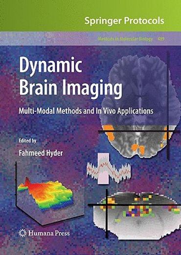 dynamic brain imaging,multi-modal methods and in vivo applications