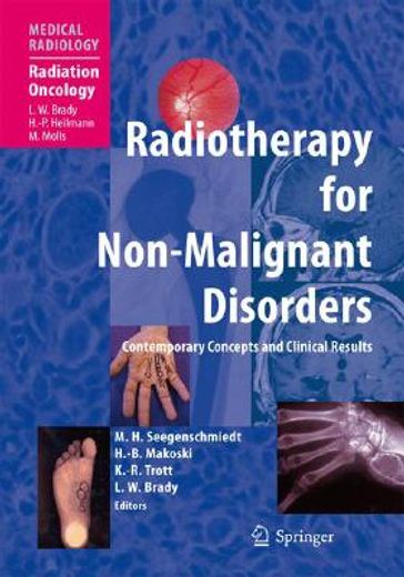 radiotherapy for non-malignant disorders