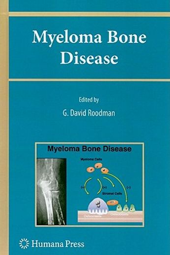 myeloma bone disease