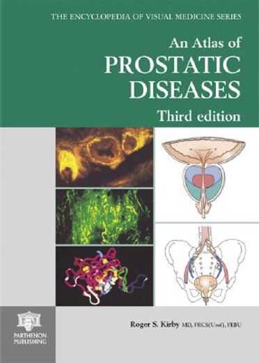 an atlas of prostatic diseases 3 ed.