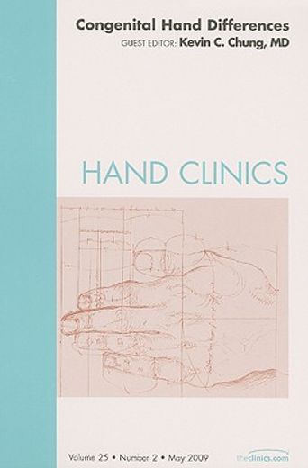 Congenital Hand Differences, an Issue of Hand Clinics: Volume 25-2 (en Inglés)