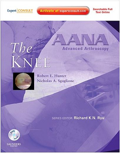 The Knee [With CDROM] (en Inglés)