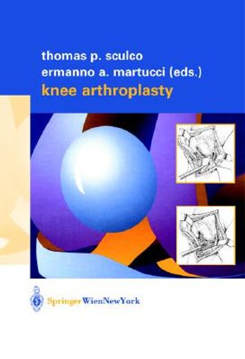 knee arthroplasty (en Inglés)
