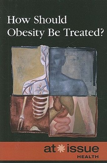 how should obesity be treated?
