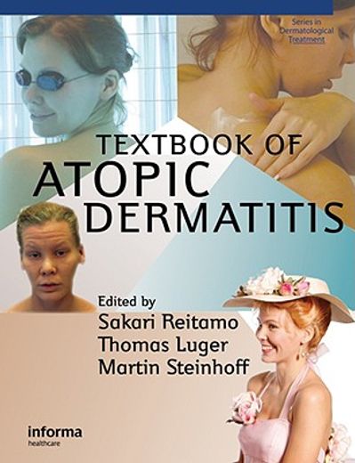 Textbook of Atopic Dermatitis (en Inglés)