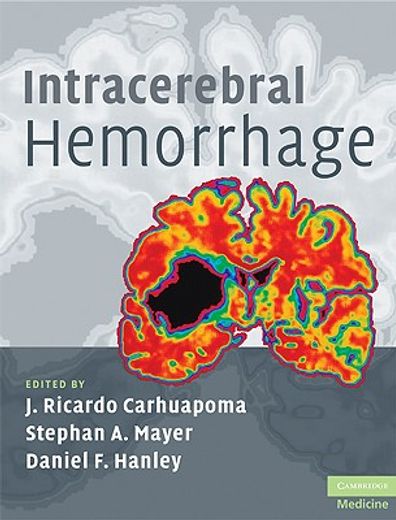 Intracerebral Hemorrhage (en Inglés)