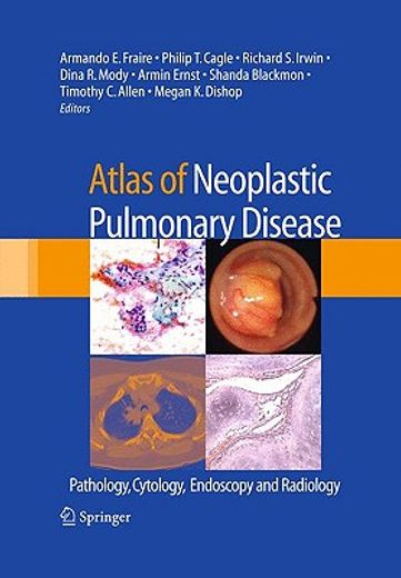 atlas of neoplastic pulmonary disease,pathology, cytology, endoscopy and radiology