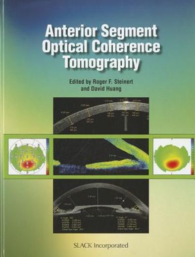anterior segment optical coherence tomography