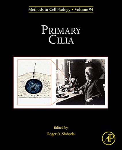 primary cilia