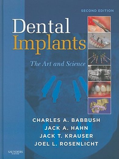 Dental Implants: The Art and Science (en Inglés)
