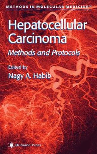 hepatocellular carcinoma,methods and protocols