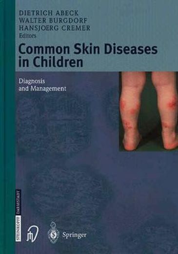 common skin diseases in children,diagnosis and management