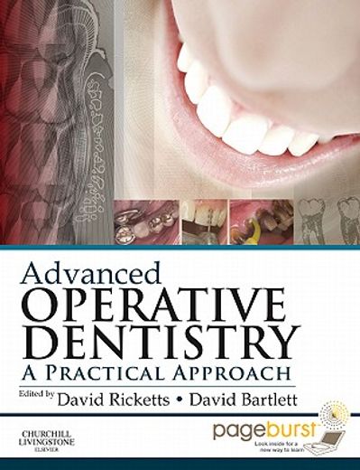 advanced operative dentistry,a practical approach