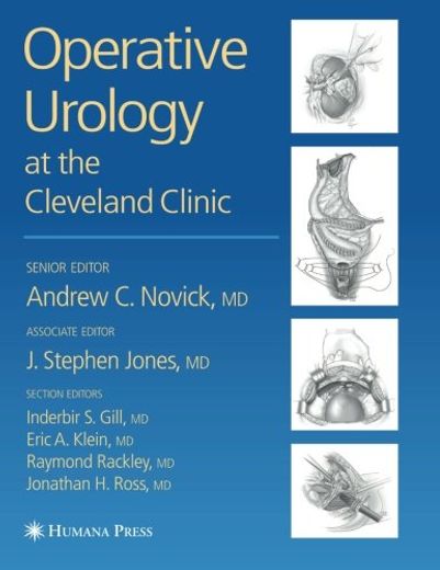 Operative Urology (en Inglés)