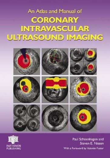 An Atlas and Manual of Coronary Intravascular Ultrasound Imaging (en Inglés)
