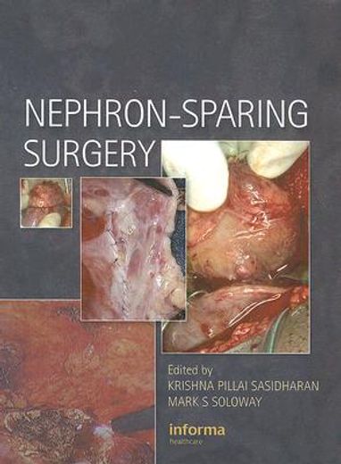 Nephron-Sparing Surgery (en Inglés)