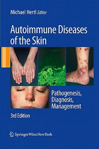 autoimmune diseases of the skin,pathogenesis, diagnosis, management
