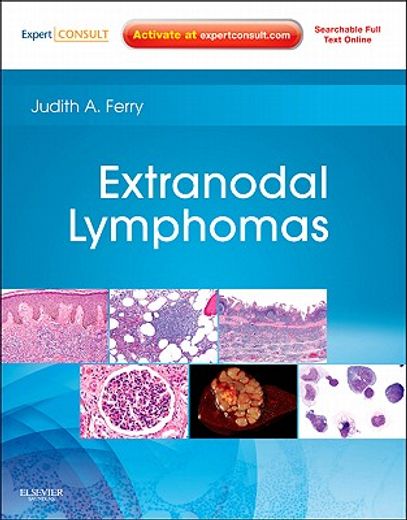 Extranodal Lymphomas: Expert Consult - Online and Print (en Inglés)