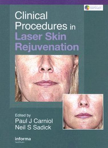 clinical procedures in laser skin rejuvention
