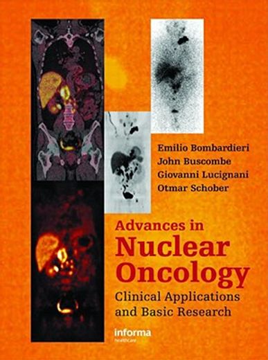 advances in nuclear oncology,diagnosis and therapy