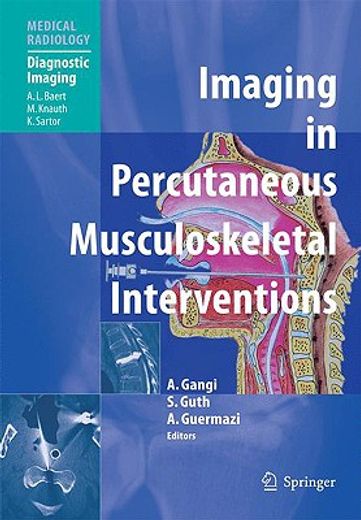 imaging in percutaneous musculoskeletal interventions