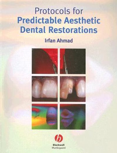 Protocols for Predictable Aesthetic Dental Restorations (in English)