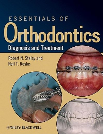 essentials of orthodontics,diagnosis and treatment