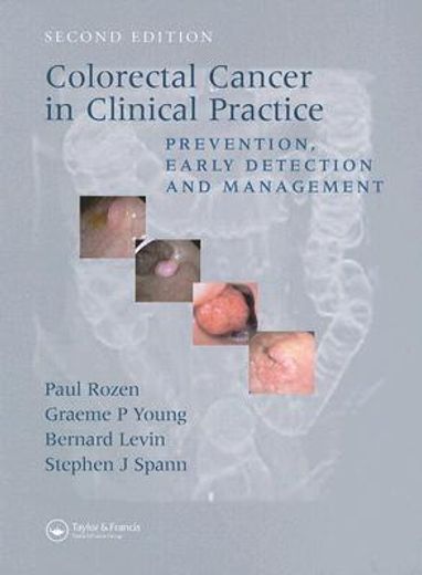 Colorectal Cancer in Clinical Practice: Prevention, Early Detection and Management, Second Edition (en Inglés)
