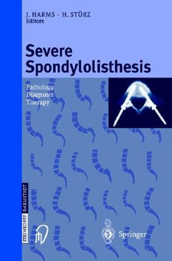 severe spondylolisthesis (en Inglés)