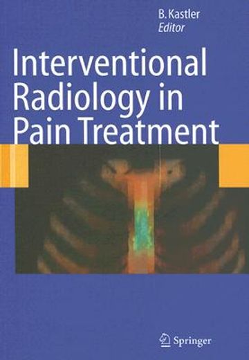 interventional radiology in pain treatment