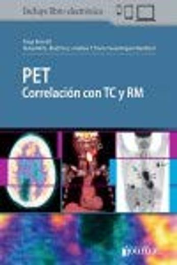 PET Correlación con TC y RM (in Spanish)
